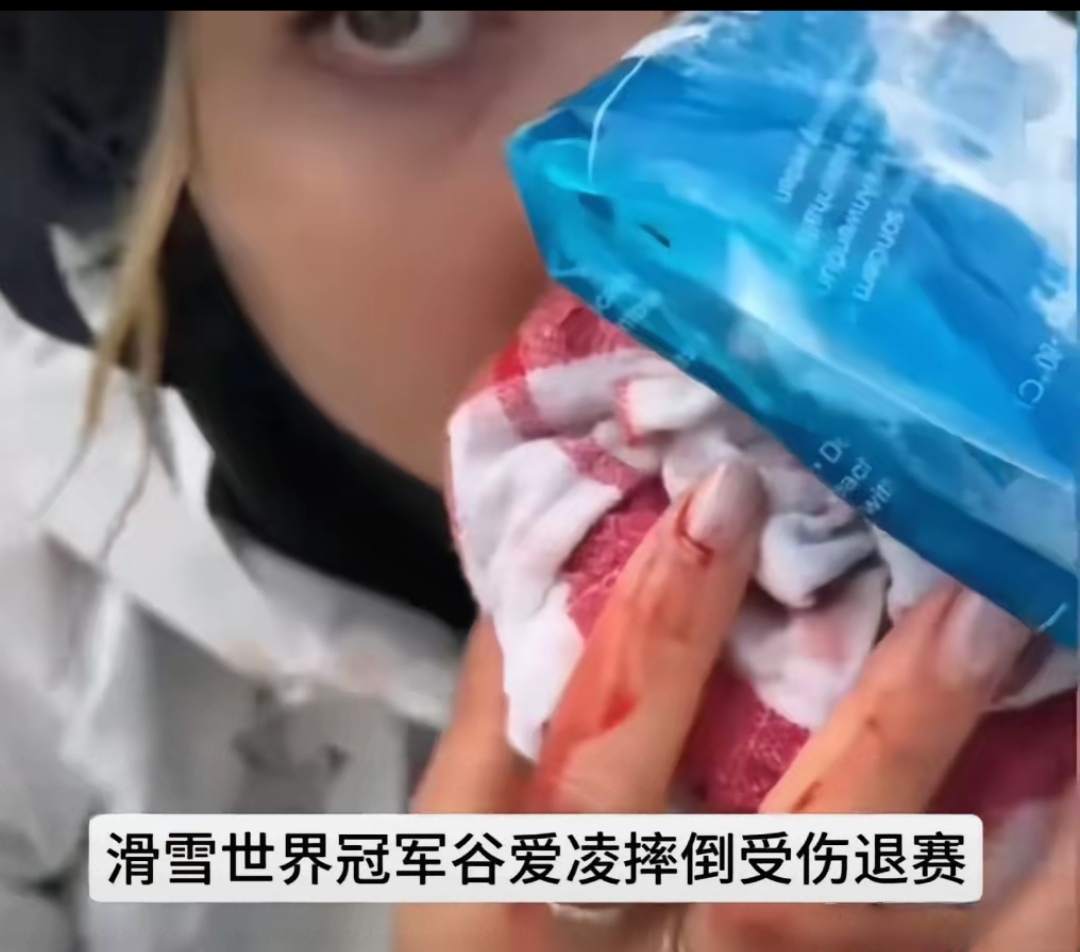 赛场上突发意外,受伤选手退赛 赛场上突发意外,受伤选手退赛